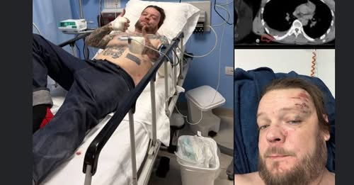Corey Harrison’s Painful Accident in Mexico: 11 Broken Ribs, Misses His Dad’s Wedding