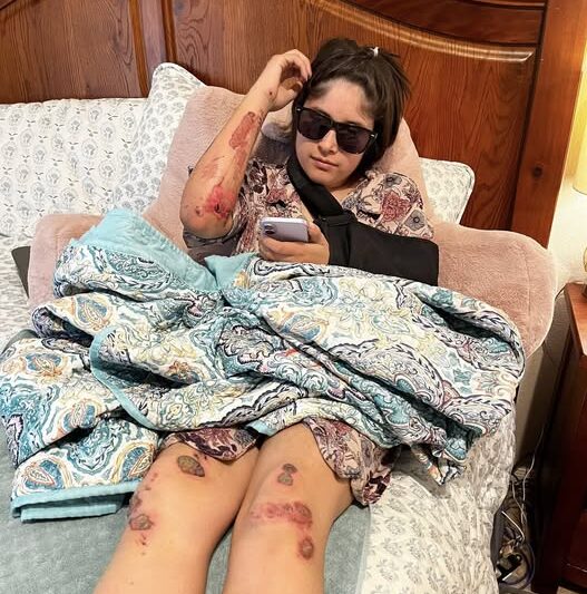 Young Woman Immersed in Grace Following Terrifying Road Accident